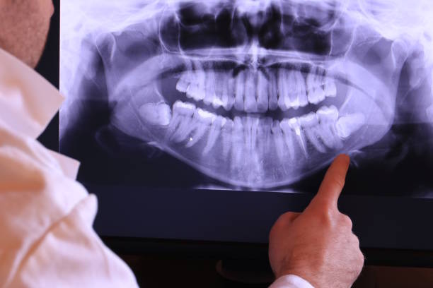 Best Pediatric Emergency Dentist in Old Hill, CT